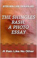 Algopix Similar Product 15 - The Shingles Rash A Photo Essay A