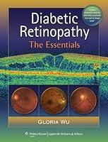 Algopix Similar Product 2 - Diabetic Retinopathy: The Essentials