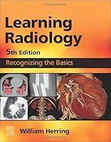 Algopix Similar Product 15 - Learning Radiology Recognizing the