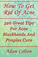 Algopix Similar Product 5 - How To Get Rid Of Acne 326 Great Tips