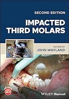 Algopix Similar Product 15 - Impacted Third Molars