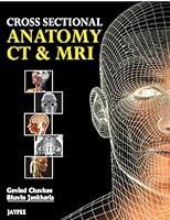 Algopix Similar Product 11 - Cross Sectional Anatomy CT and MRI