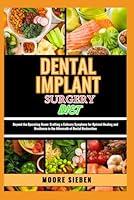 Algopix Similar Product 2 - DENTAL IMPLANT SURGERY DIET Beyond the