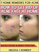 Algopix Similar Product 17 - 7 Home Remedies for Acne  How to Get