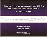 Algopix Similar Product 9 - Rapid Interpretation of ECGs in