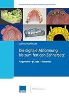 Algopix Similar Product 4 - Die digitale Abformung bis zum fertigen