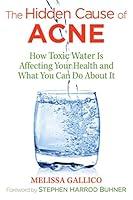 Algopix Similar Product 16 - The Hidden Cause of Acne How Toxic