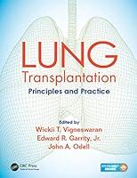 Algopix Similar Product 18 - Lung Transplantation Principles and