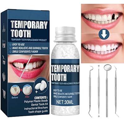 Teeth Repair Kit, Temporary Teeth replacement kit, Moldable False Teeth,  Thermal Fitting Beads for Snap On