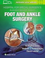 Algopix Similar Product 16 - Hospital for Special Surgerys