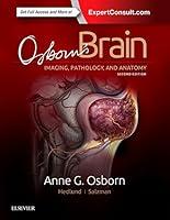 Algopix Similar Product 4 - Osborn's Brain