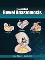 Algopix Similar Product 11 - Essentials of Bowel Anastomosis