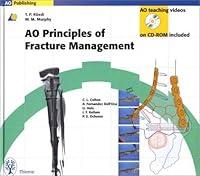 Algopix Similar Product 7 - Ao Principles of Fracture Management