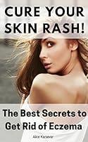 Algopix Similar Product 9 - Cure Your Skin Rash The Best Secrets