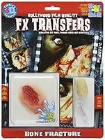 Algopix Similar Product 8 - Tinsley Transfers Bone Fracture
