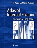 Algopix Similar Product 16 - Atlas of Internal Fixation Fractures