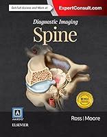 Algopix Similar Product 10 - Diagnostic Imaging: Spine
