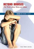 Algopix Similar Product 15 - Beyond Bruises The Truth about Teens