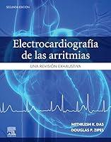 Algopix Similar Product 10 - Electrocardiografa de las arritmias