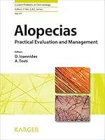 Algopix Similar Product 17 - Alopecias Practical Evaluation and