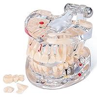 Algopix Similar Product 7 - Annhua Transparent Tooth Model Dental