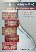Algopix Similar Product 4 - Toothwear: The ABC of the Worn Dentition