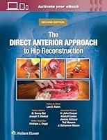 Algopix Similar Product 13 - The Direct Anterior Approach to Hip