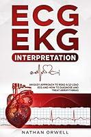 Algopix Similar Product 14 - ECGEKG Interpretation An Easy