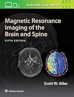 Algopix Similar Product 7 - Magnetic Resonance Imaging of the Brain