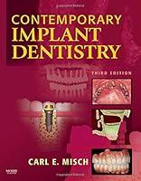 Algopix Similar Product 13 - Contemporary Implant Dentistry