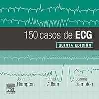 Algopix Similar Product 11 - 150 casos de ECG (Spanish Edition)