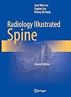 Algopix Similar Product 19 - Radiology Illustrated: Spine