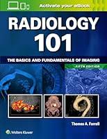 Algopix Similar Product 3 - Radiology 101 The Basics and