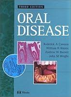 Algopix Similar Product 18 - Oral Disease