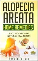 Algopix Similar Product 17 - Alopecia Alopecia Areata Home