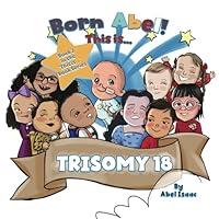 Algopix Similar Product 3 - This Is Trisomy 18 This Is Books