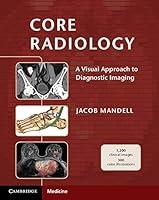 Algopix Similar Product 12 - Core Radiology A Visual Approach to