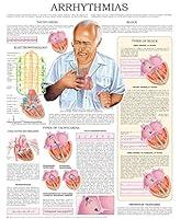 Algopix Similar Product 2 - Arrhythmias echart Quick reference