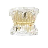 Algopix Similar Product 2 - Dental Teeth ModelTransparent Dental
