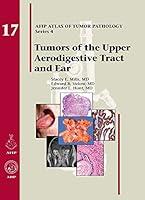 Algopix Similar Product 13 - Tumors of the Upper Aerodigestive Tract