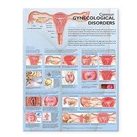 Algopix Similar Product 11 - Common Gynecological Disorders