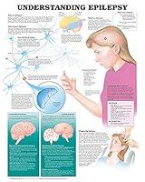Algopix Similar Product 12 - Understanding Epilepsy Anatomical Chart