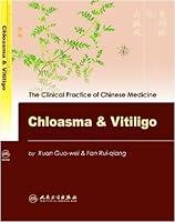 Algopix Similar Product 6 - Chloasma  Vitiligo The Clinical