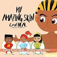 Algopix Similar Product 8 - My Amazing Skin Can Heal A Book About