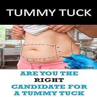 Algopix Similar Product 10 - Tummy Tuck Are You the Right Candidate