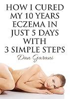 Algopix Similar Product 3 - How I Cured My 10 Years Eczema In Just