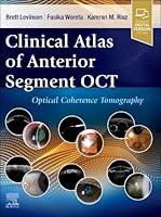 Algopix Similar Product 15 - Clinical Atlas of Anterior Segment OCT