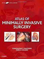 Algopix Similar Product 11 - Atlas of Minimally Invasive Surgery