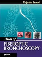 Algopix Similar Product 18 - Atlas of Fiberoptic Bronchoscopy