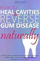 Algopix Similar Product 18 - How to Heal Cavities and Reverse Gum